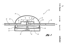 Illustration of a medical device