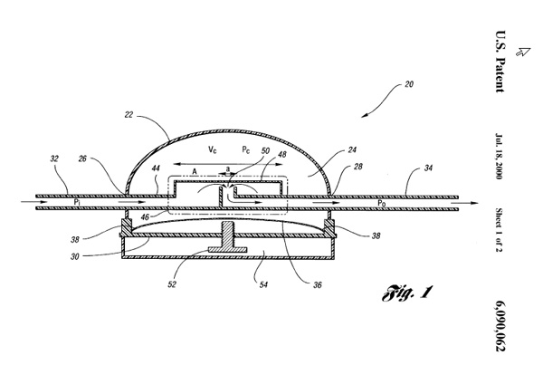 Illustration of a medical device